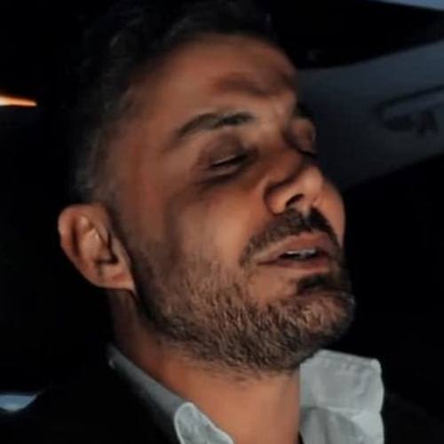 دانلود آهنگ جدید کو وه ابی عالی (کامل) دانلود آهنگ جدید کو وه ابی عالی (کامل)